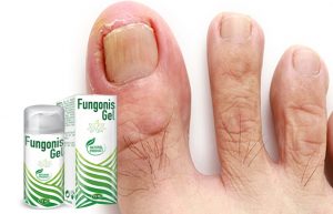 Fungonis-Gel-gel-ingrediente-compoziţie-cum-să-aplici-cum-functioneazã-efecte-secundare-contraindicații-prospect